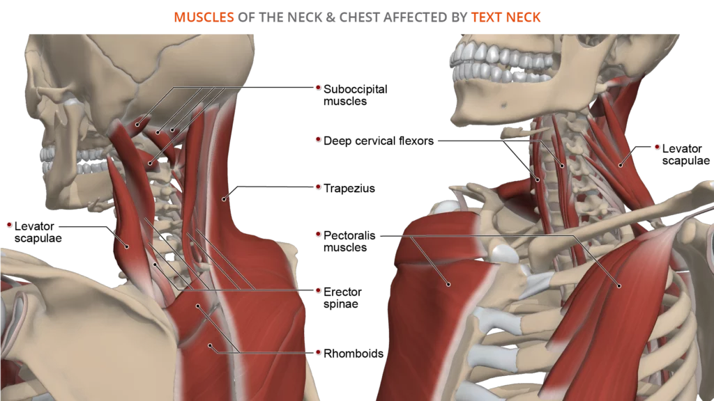 text neck - affected muscles - anatomy
