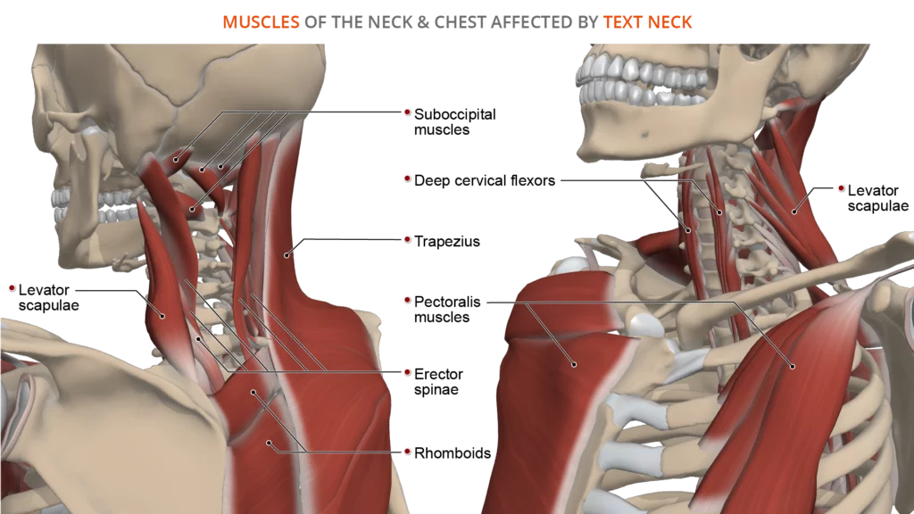 Text Neck Anatomy Of A Modern Spine Condition   Muscles Affected By Text Neck V1 1024x576 