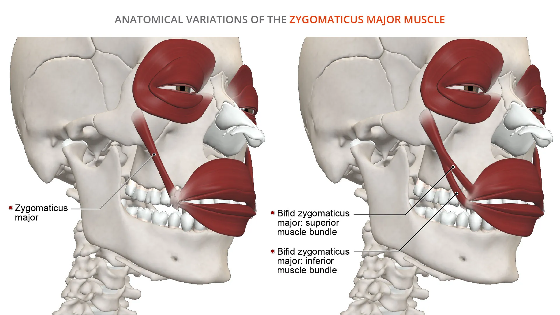 Anatomical Variations of Zygomaticus Major Muscle